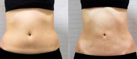 上海疤痕科醫(yī)院哪家好？綜合評測2023，含專家問答與真實(shí)患者見證