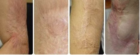 南京去紅血絲醫(yī)院專業(yè)推薦：哪家醫(yī)院技術(shù)高效、費(fèi)用合理？