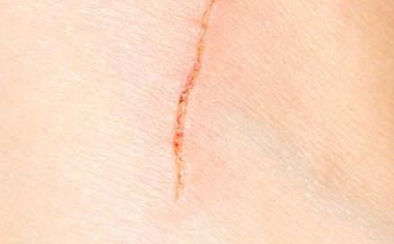 深圳去眼袋醫(yī)院哪家技術(shù)先進，效果好