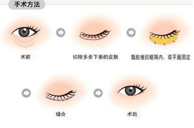 南寧治療痘印哪家醫(yī)院靠譜？—用戶(hù)首選南寧去痘印醫(yī)院排行榜