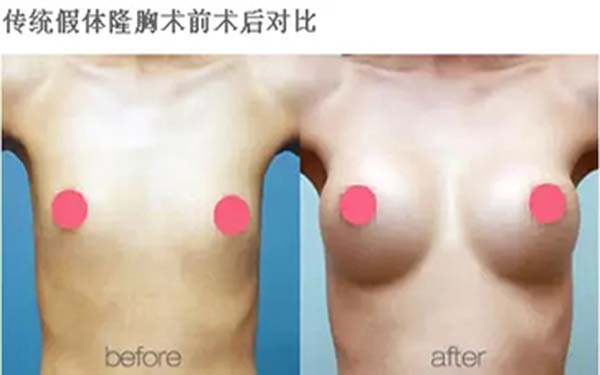 溫州雍禾醫(yī)院信譽如何？求推薦占家佳醫(yī)生植發(fā)效果如何？或溫州雍禾醫(yī)院口碑怎么樣？哪位醫(yī)生適合占家佳植發(fā)