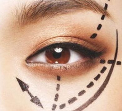 蘭州眼睛美容醫(yī)院哪家好？揭秘蘭州市最受歡迎的眼睛美容醫(yī)院排行榜！