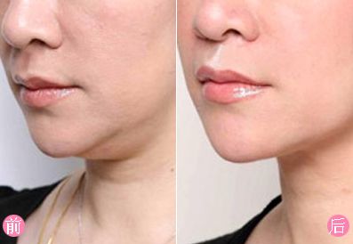 瀘州去疤痕哪家醫(yī)院好？疤痕修復(fù)盡在XXX專科醫(yī)院！