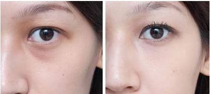 杭州哪家醫(yī)院做狐臭手術好且靠譜？