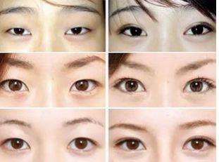 武漢去眼袋哪家好可信？揭秘眼袋整形專家推薦排行榜！