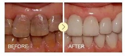 西安畫美楊萬(wàn)忠鼻部整形效果解析！楊萬(wàn)忠醫(yī)生簡(jiǎn)介及收費(fèi)準(zhǔn)則！