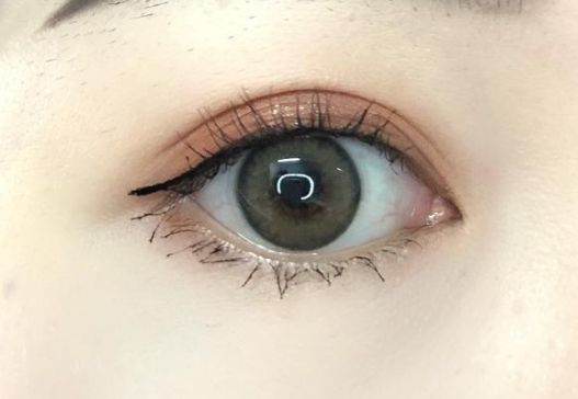 重慶去疤痕醫(yī)院有哪些專家？哪家去疤痕醫(yī)院好？