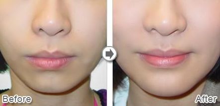 沈陽星美北順城醫(yī)療美容診所怎么樣？沈陽星美北順城醫(yī)療美容診所簡(jiǎn)介|醫(yī)生團(tuán)隊(duì)|口碑評(píng)價(jià)！