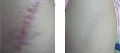 上海割眼袋哪家醫(yī)院靠譜？如何選擇上海割眼袋醫(yī)院？