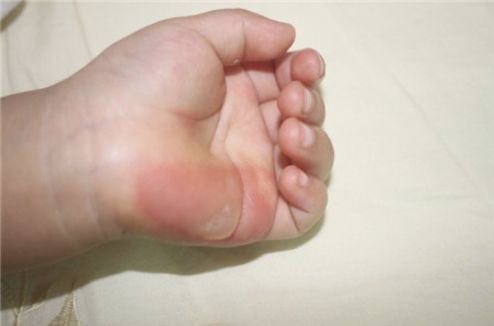 雙眼皮手術(shù)武漢哪家醫(yī)院好？熱門推薦及口碑解讀