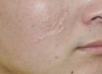 合肥整容醫(yī)生綜合排名TOP5，獨(dú)具經(jīng)驗(yàn)與在線咨詢服務(wù)