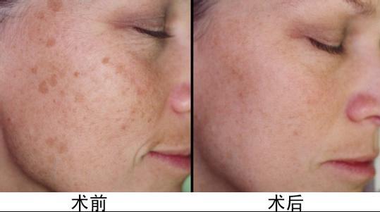 上海假體隆胸醫(yī)師推薦！王濤、亓發(fā)芝、劉天一帶您尋找完美曲線！