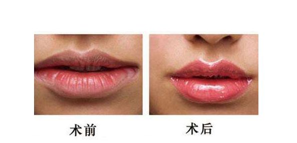 江蘇哪家醫(yī)院做激光祛斑好？