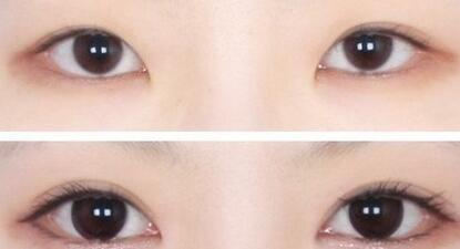 2023重慶唇紋打肉毒素專家綜合實(shí)力排行(張貴群、曹勇、孫乘林實(shí)力不賴！個(gè)人資料一覽~)