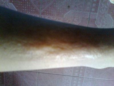 2023紹興耳軟骨隆鼻手術(shù)權(quán)威醫(yī)生榜單前十名(徐榮俊、方倫磊、謝劍入圍前四)