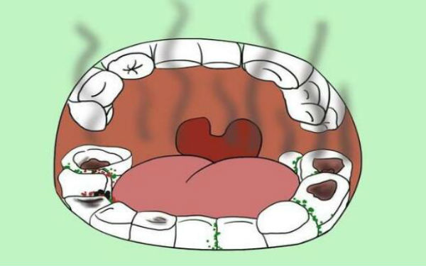 2023深圳光電治療打眼角紋排行前10名的專家(劉剛、陳孟春、杭怡寧口碑擅長盤點)