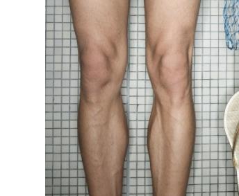 李楊西京醫(yī)院手術(shù)專家，助您完美小拉皮