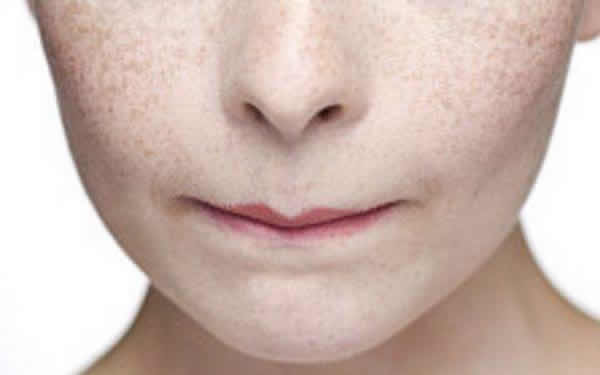 蘇州維多利亞美容醫(yī)院：李寅醫(yī)師讓除皺成為可能