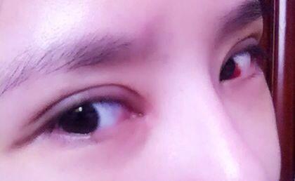 2023重慶做豐唇珠權(quán)威專家上榜前10名(吳偉、薛斌、趙小英反饋超級好)