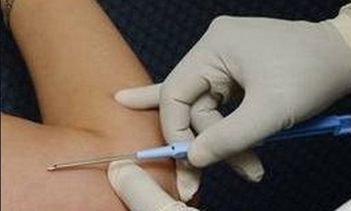 上海手術(shù)眼袋好的醫(yī)院有哪些？