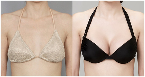 附去眼袋果圖，中心醫(yī)院邱曉東怎么樣治療效果如何