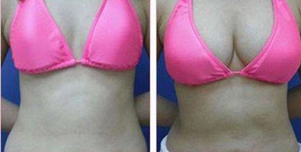 昆明哪家醫(yī)院的光子嫩膚祛斑效果好？