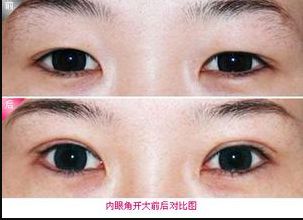 廊坊地區(qū)瘦臉針醫(yī)院排行榜2023：哪家醫(yī)院的瘦臉針效果好？