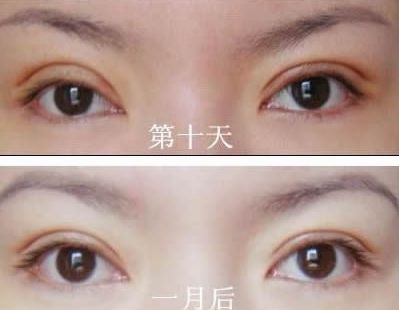 長春哪家醫(yī)院治痘痘好？了解長春市治療青春痘的?？漆t(yī)院及價格