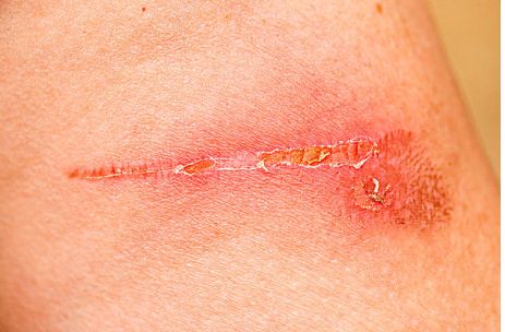 廣州整形醫(yī)院去哪家好？權(quán)威排行榜及患者口碑評價對比！