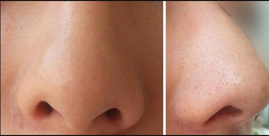 長沙鼻修復(fù)領(lǐng)域，哪位醫(yī)生口碑比較好的？五位知名專家匯總，推薦熱門醫(yī)師吳蒙！