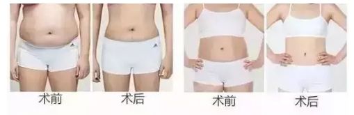 信陽去整形哪家醫(yī)院好？名副其實(shí)信陽市最佳整形醫(yī)院TOP推薦