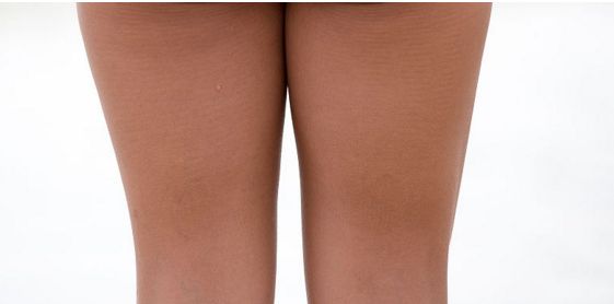 杭州治疤痕那個醫(yī)院好？解析杭州治疤痕醫(yī)院榜單