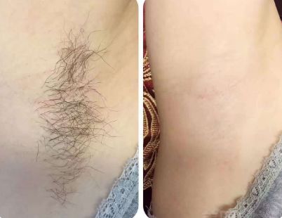 上海整形醫(yī)院哪家的好？最權(quán)威的排名榜單來幫你挑選！