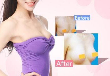 天津哪家醫(yī)院去疤痕好？專業(yè)醫(yī)生推薦的天津去疤痕頂級醫(yī)院有哪些？