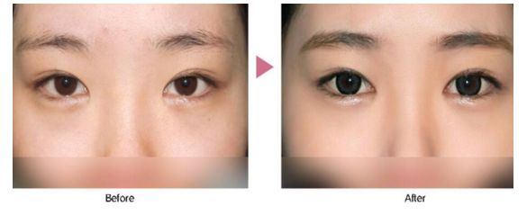 珠海整形醫(yī)院去哪家好？挑選術(shù)前評價好的整形醫(yī)院，放心修復您的美麗