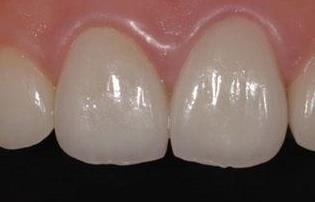 2023武漢面部負(fù)壓吸脂前10位醫(yī)生口碑榜(陜聲國(guó)、楊斐、汪蒙霞實(shí)力口碑樣樣不差)