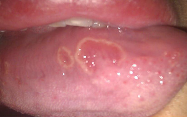 2023太原鉆石光祛斑正規(guī)專家排行榜TOP10強(qiáng)(吳長發(fā)、樸用三、李正彬技術(shù)真的很nice！)