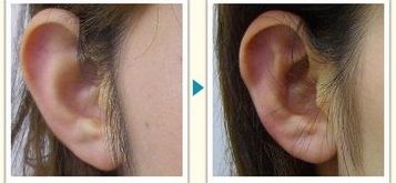 成都燒傷整形醫(yī)院哪家好？燒傷康復中心排名TOP5，專家支招！