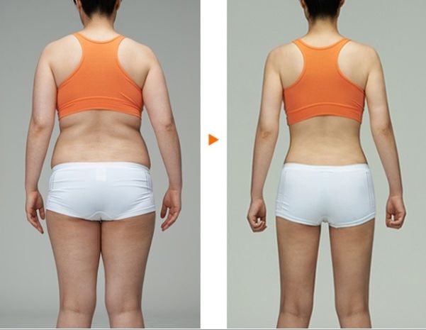 南京吸脂瘦臉哪家醫(yī)院好？全面解析南京吸脂手術(shù)的醫(yī)院排名及選擇攻略