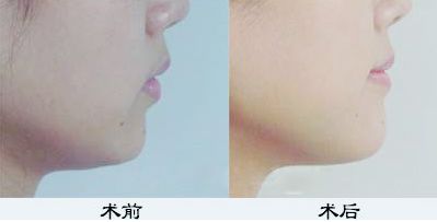 鄭州鼻綜合哪家醫(yī)院好？TOP醫(yī)療機(jī)構(gòu)大揭秘