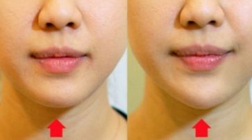 南京整容手術(shù)最靠譜的醫(yī)院排行榜，告訴你南京做整容手術(shù)醫(yī)院哪家好