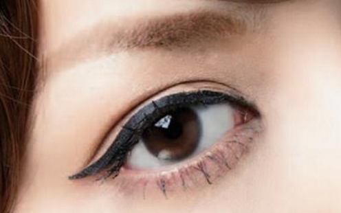 貴陽(yáng)雙眼皮整形醫(yī)生推薦：劉德東、徐威、陳誠(chéng)等技術(shù)可靠！