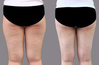 菏澤市整形醫(yī)院哪家好？排名榜單發(fā)布