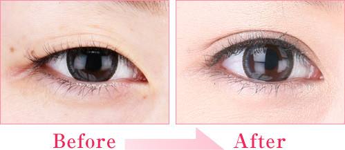 2023濟南激光治療老年斑權威專家排名前十強(張敬花、曹京敏、祝曉青推薦給你！)