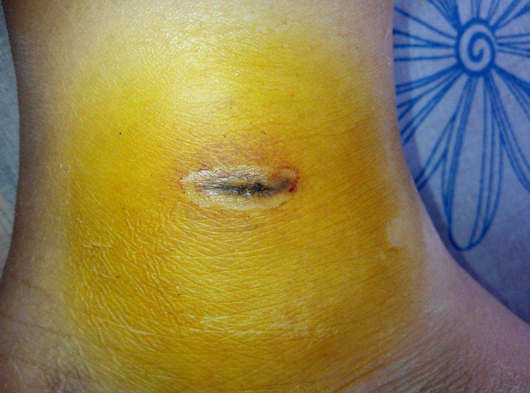 2023青海胸部脂肪填充排行前十名的醫(yī)生(周龍、張光武、張光武本地網(wǎng)友熱捧)