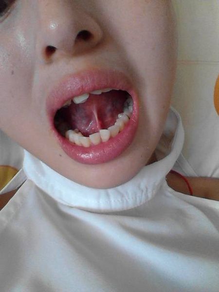 2023寧波botox除皺針權(quán)威專家排行前10強(qiáng)(茅來發(fā)、龔全康、田柏怡技術(shù)特色分享！)