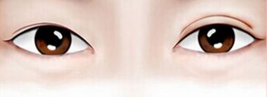 上海哪家醫(yī)院擅長(zhǎng)激光治療？