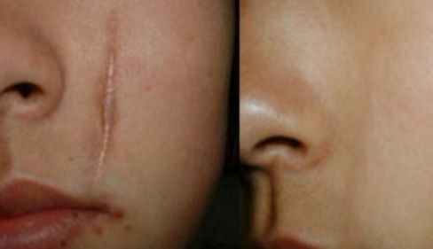 烏魯木齊眼袋手術(shù)專家推薦，哪家醫(yī)院好？