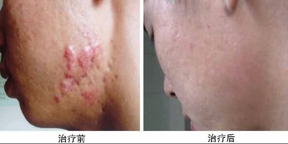 南京哪家醫(yī)院做兔唇手術(shù)效果好又安全？