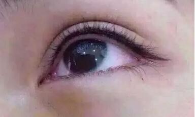 八大處整容醫(yī)院閆言皮膚性病治療的療效如何評價？